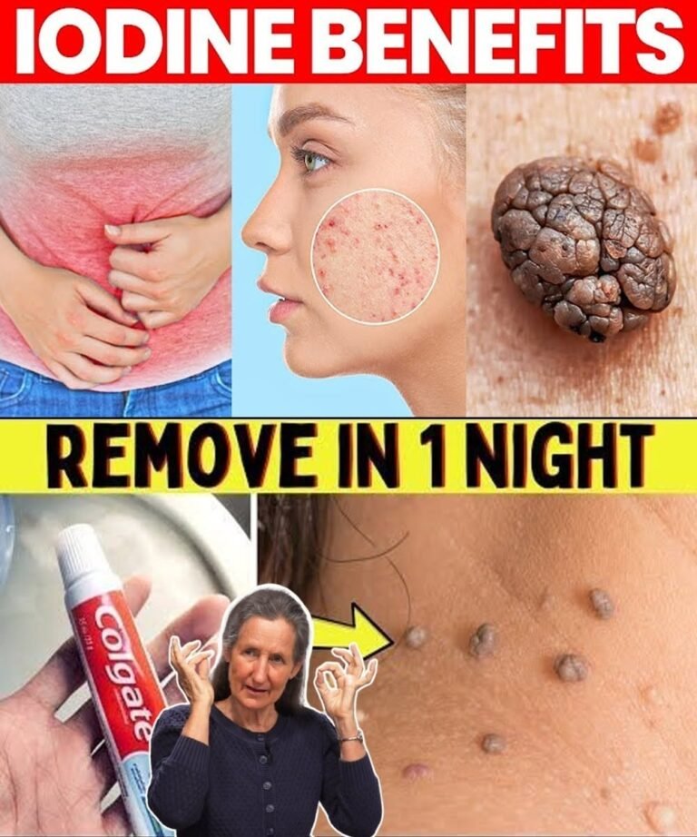 🌿 Remove Warts & Skin Tags Naturally With This Simple 3-Ingredient Blend