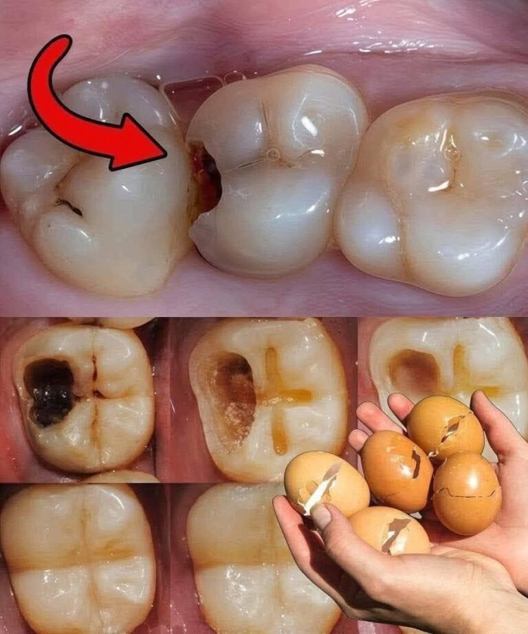 After 5 Minutes, Yellow Teeth Turn Pearl White — The Gentle Whitening Secret with Eggshells
