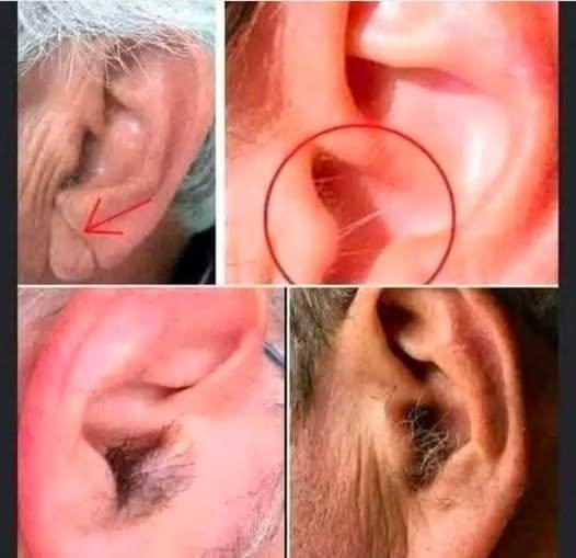 Did you know that if your ear hairs grow, it is because your body is