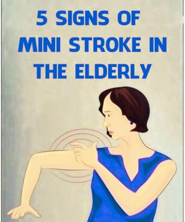 Mini-Stroke in the Elderly: Recognizing Symptoms and Seeking Proper Car