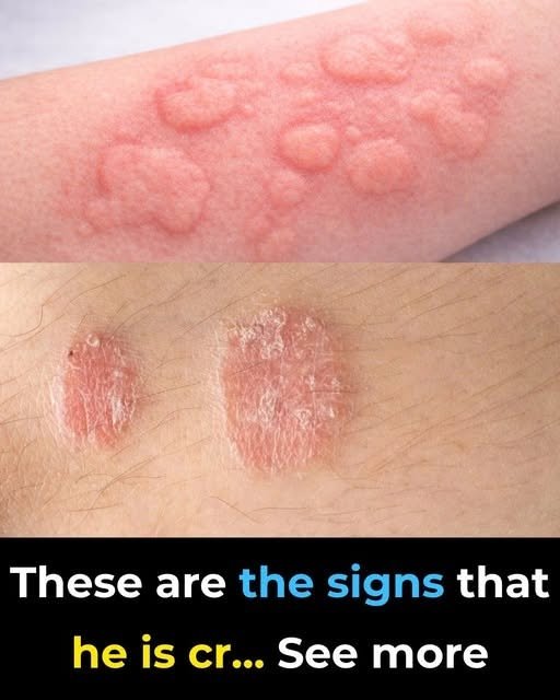 These are the signs that he is cr… See more