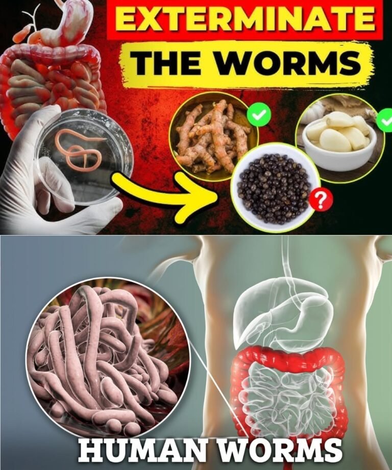EXTERMINATE the Worms: 14 Powerful Foods That Kill Intestinal Parasites (NOT What You Think!)