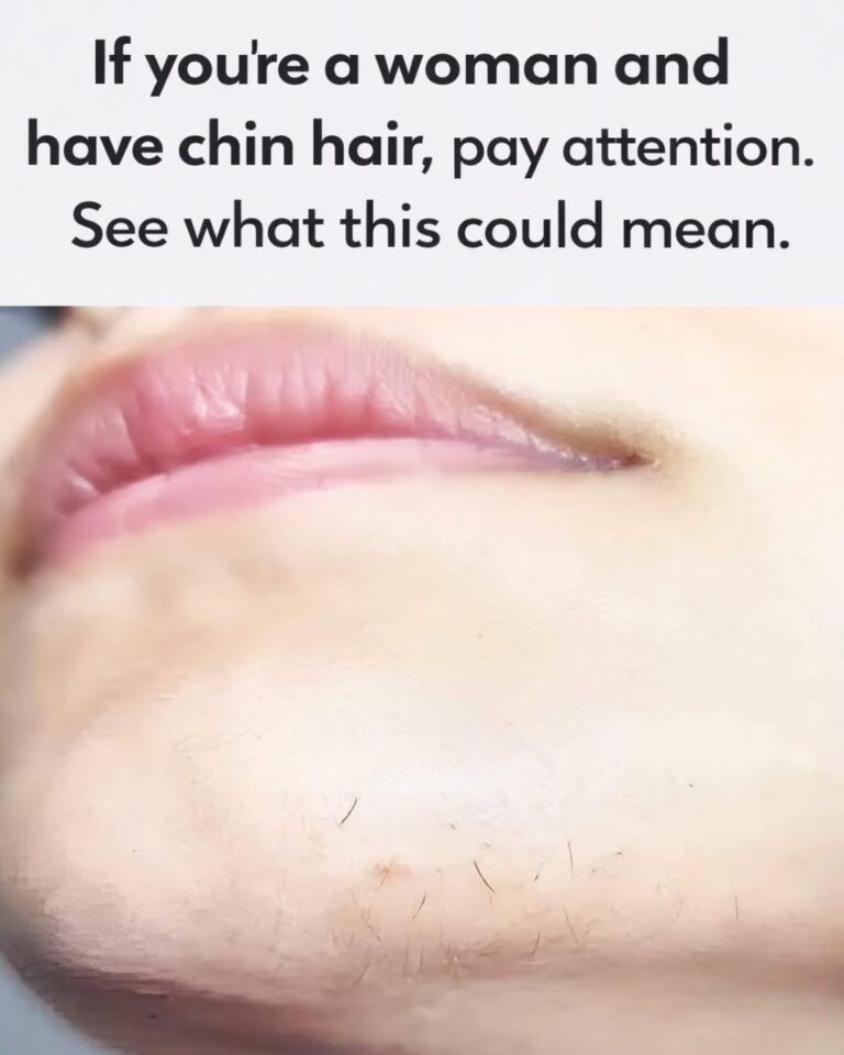 Chin Hair in Women: What It Could Mean for Your Health
