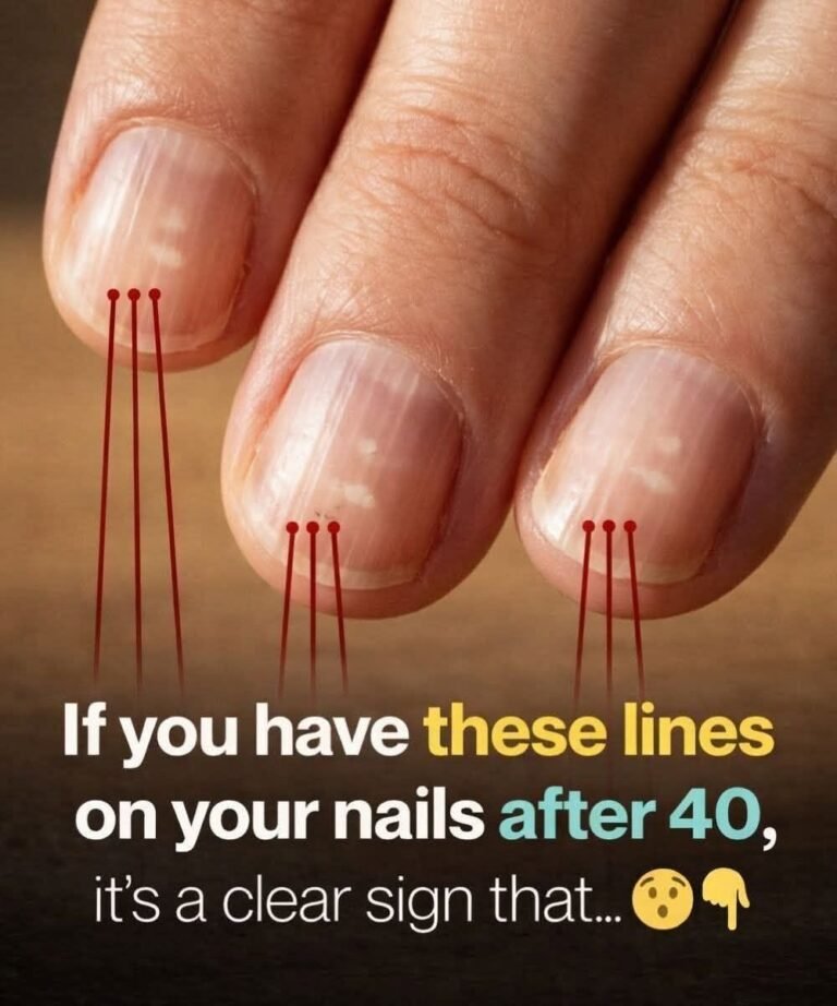 7 Best Foods for Stronger, Healthier Nails After 40 (Doctor-Recommended Nutrition Guide)