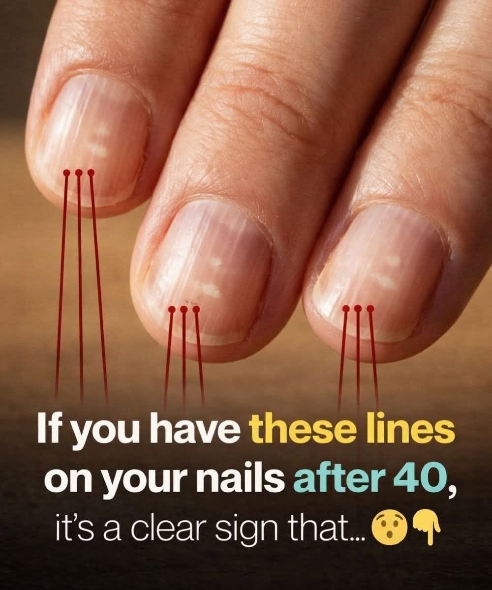 7 Best Foods for Stronger, Healthier Nails After 40 (Doctor-Recommended Nutrition Guide)