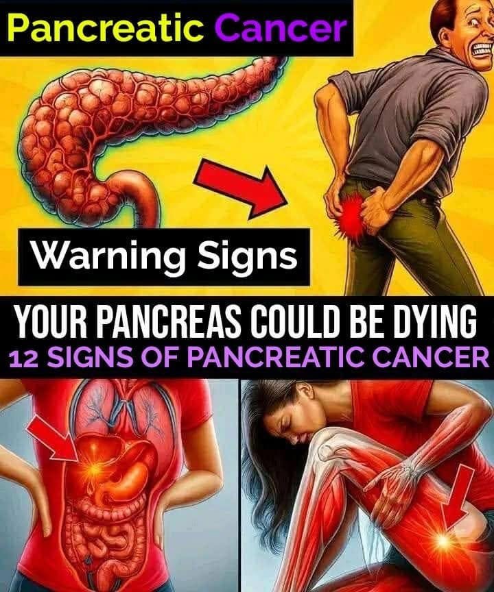 11 Warning Signs of Pancreatic Cancer You Should Never Ignore — Doctors Explain Every Symptom