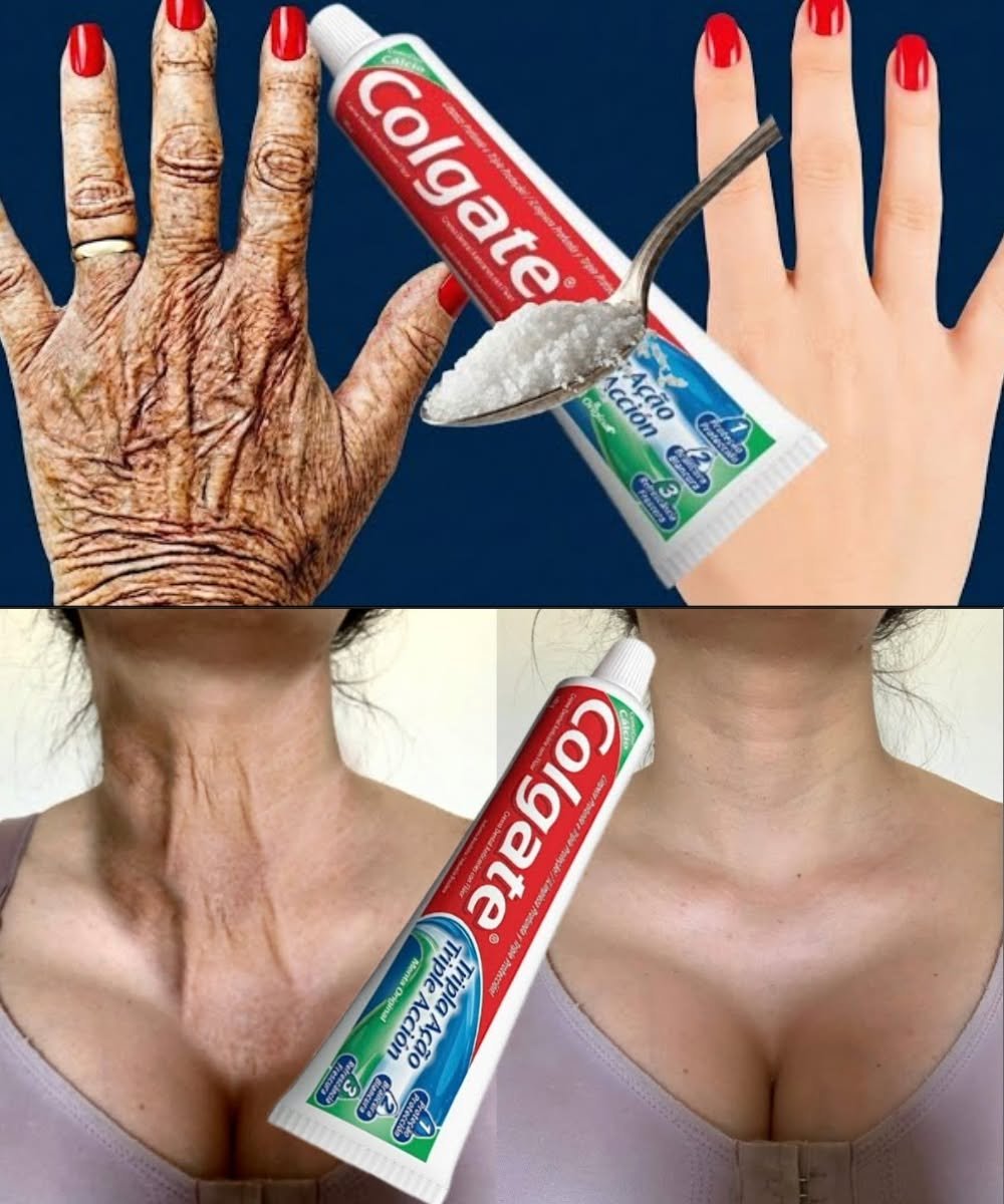 “It Looks Like I Had a Cosmetic Procedure”: The At-Home Remedy People Are Using to Improve the Appearance of Wrinkles and Dark Spots on Hands and Arms