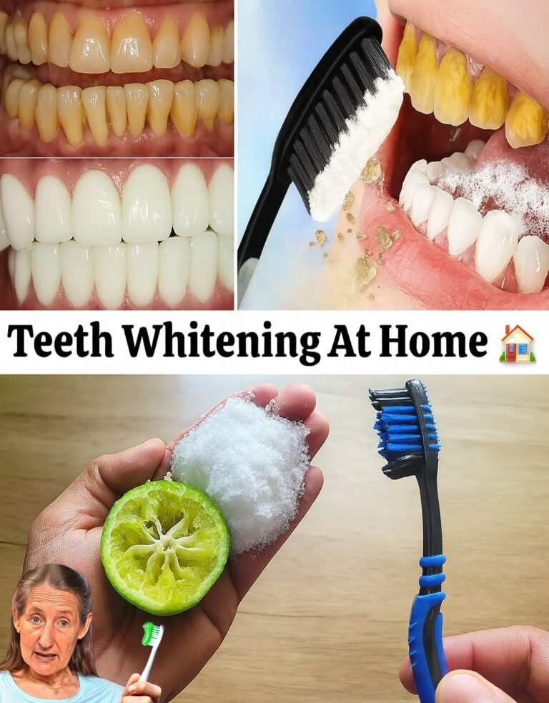 7 Powerful Home Remedies to Whiten Your Teeth Naturally