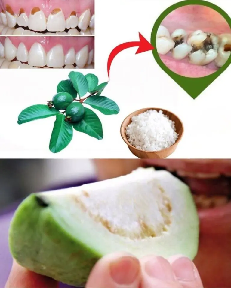🌿 Discover Nature’s Secret: 3 Powerful Guava Leaf Remedies to Support Oral Health & Reduce Tooth Decay