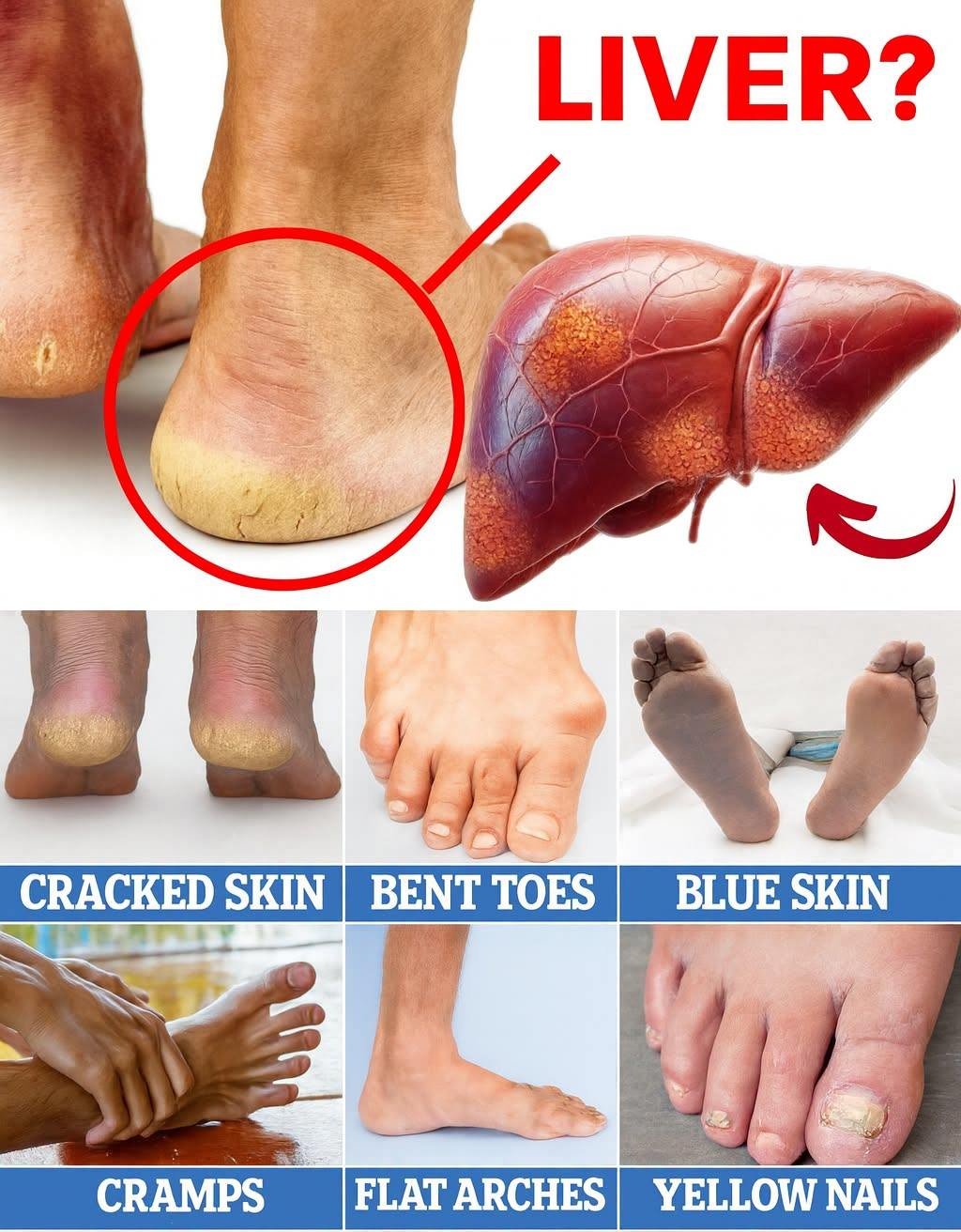 What Your Feet Can Tell You About Your Health – 6 Warning Signs You Shouldn’t Ignore