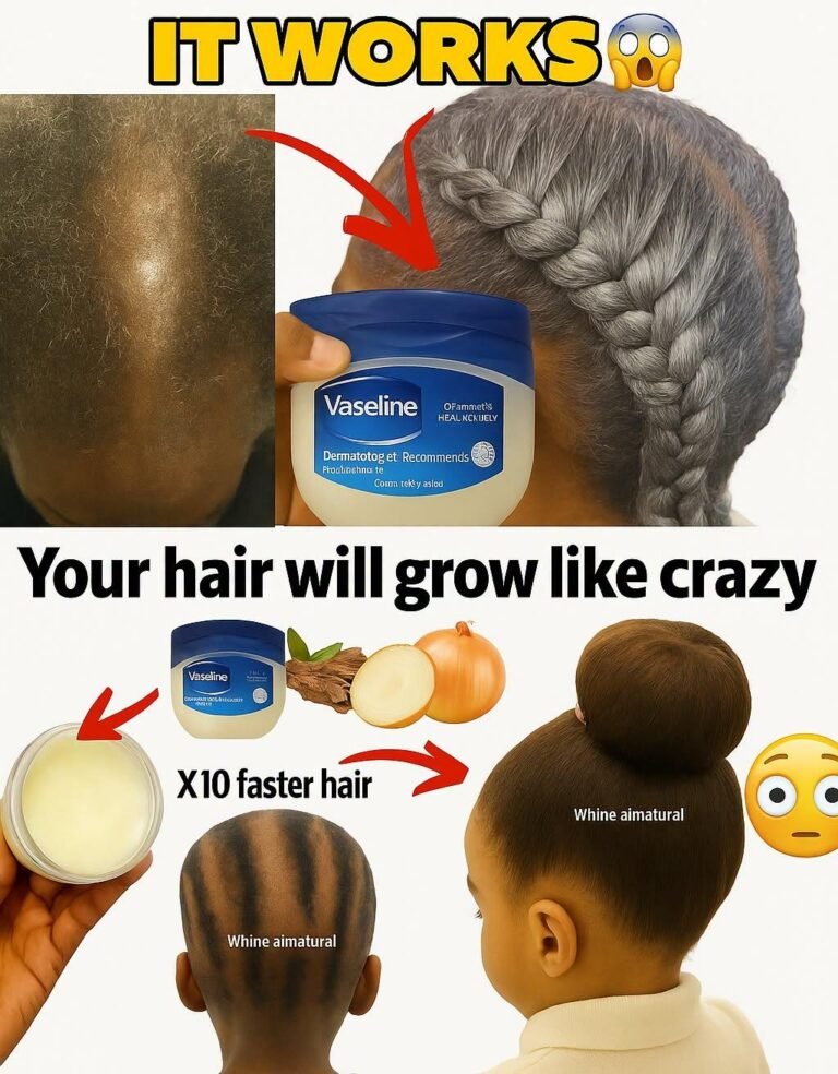 Mix Vaseline, Cloves & Onion for Faster Hair Growth: See Changes in Just 2 Weeks!