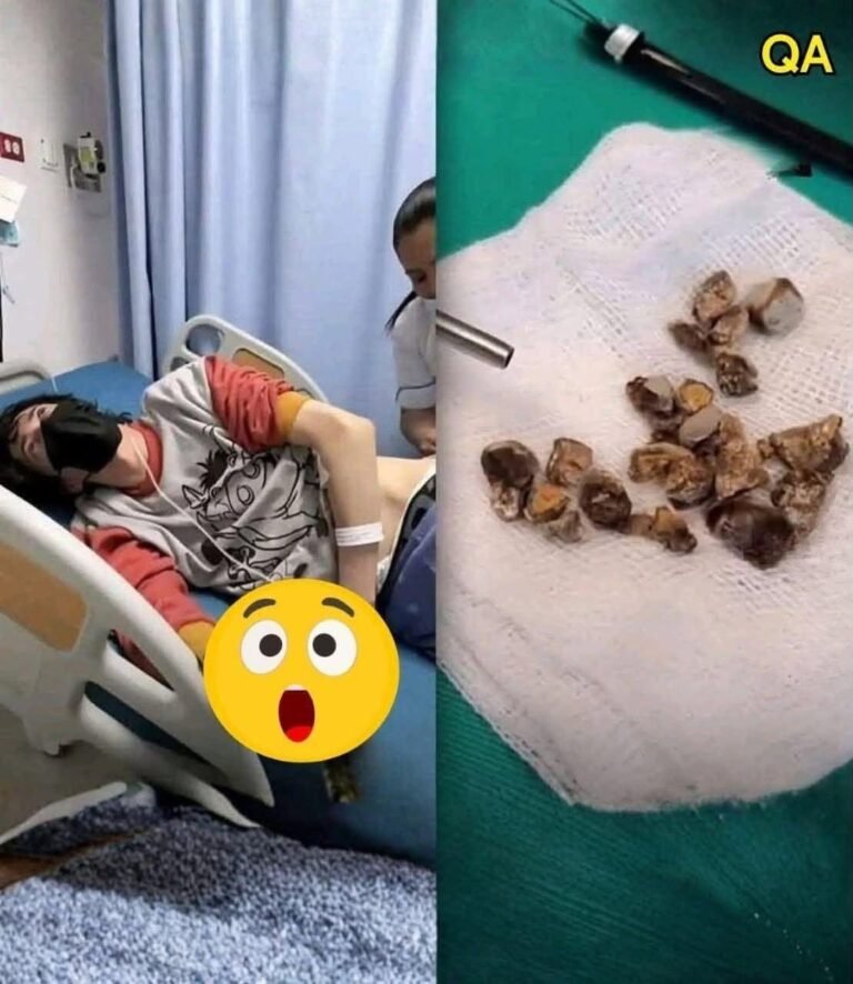 Man Hospitalized After Allowing Himself to Be Penetrated: The Health, Safety, and Social Lessons Behind the Viral Story