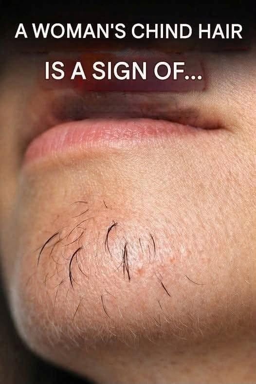 What Chin Hair in Women Really Says About Horm:ones