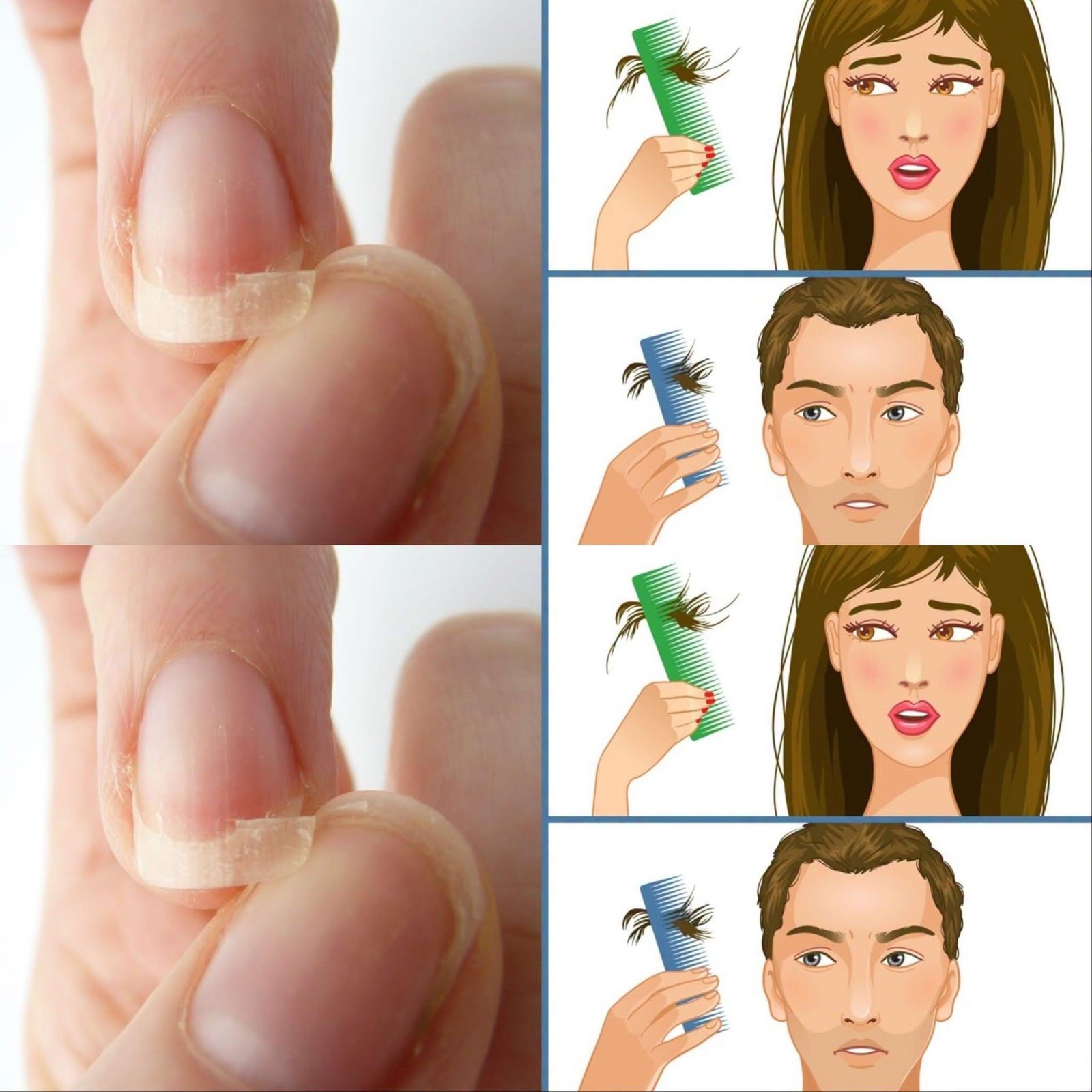 If You Have Thin Brittle Nails, Insomnia Or Hair Loss, Start Eating This!