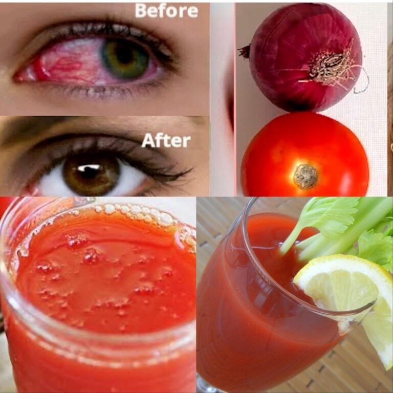 Tomato in 5 days to improve bad eyesight without glasses / In 5 days Tomato remedy for bad eyesight