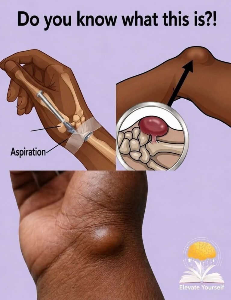 5 Things You Should Know Before Touching a Lump on Your Wrist!