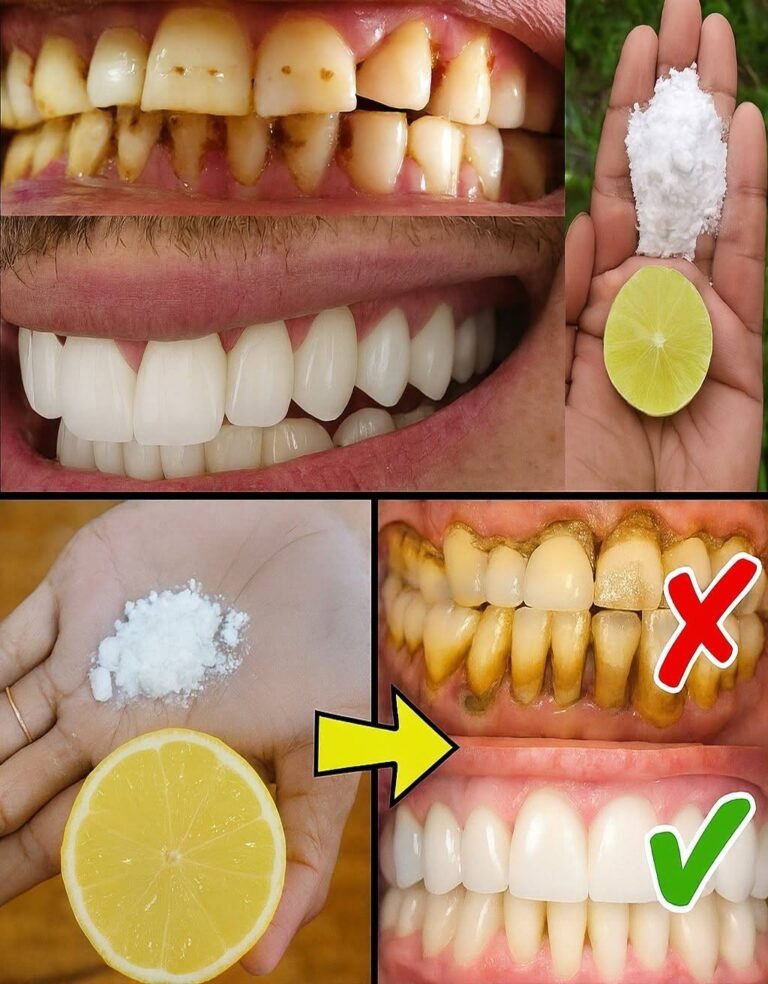  The Truth About Lemon and Baking Soda for a Radiant Smile