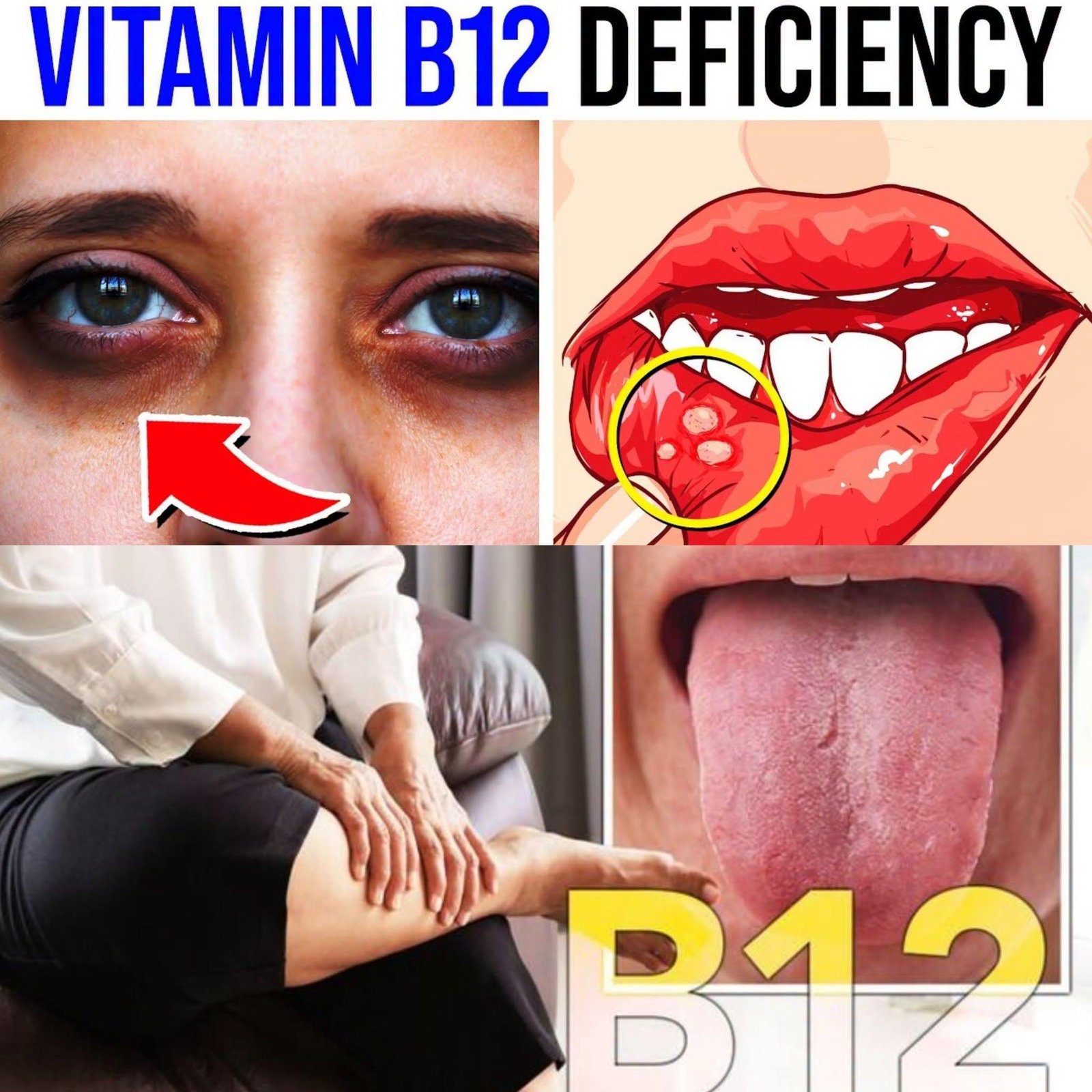 7 STRANGE Signs Your Body Is Begging for VITAMIN B12 (You Won’t Believe #5!)