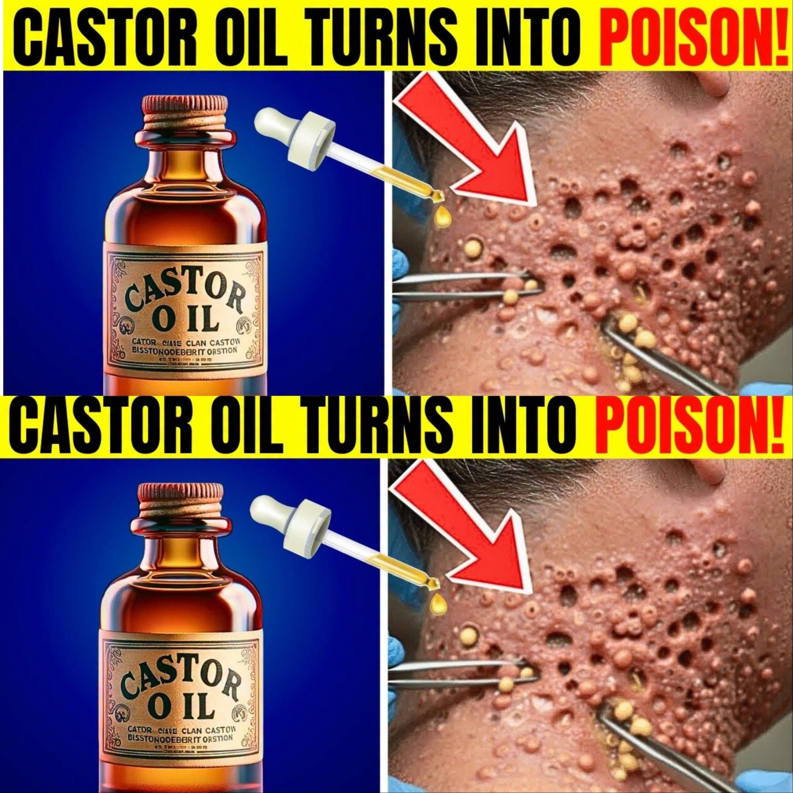 Just 2 Drops of Castor Oil in Your Navel: What This Simple Nighttime Ritual Can Really Do