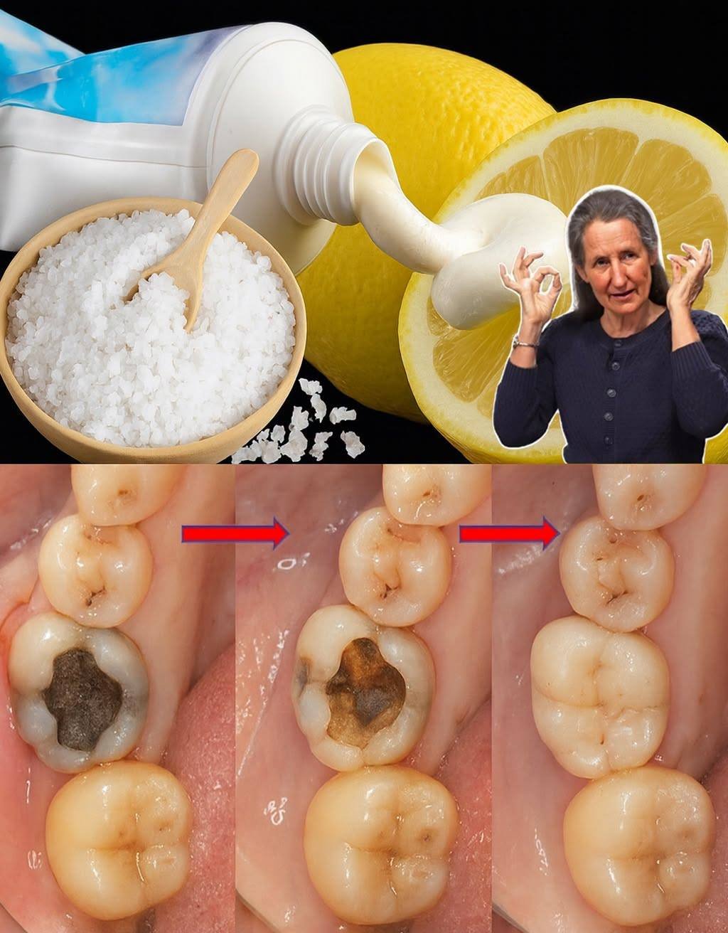 THE MINERAL REBOOT: Can You Naturally Support Tooth Enamel? Yes—Here’s How