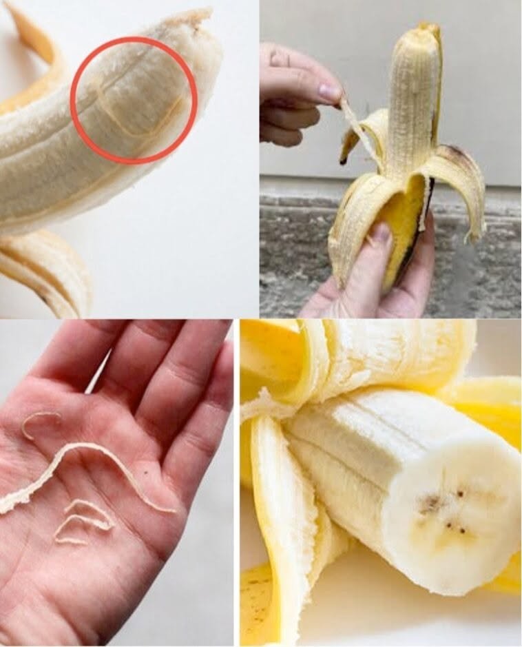 Banana Phloem Bundles: Unraveling the Hidden Threads of Health