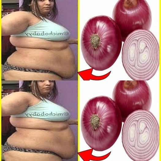 How I Lost Belly Fat in 7 Days with Onion: No Strict Diet, No Workout!