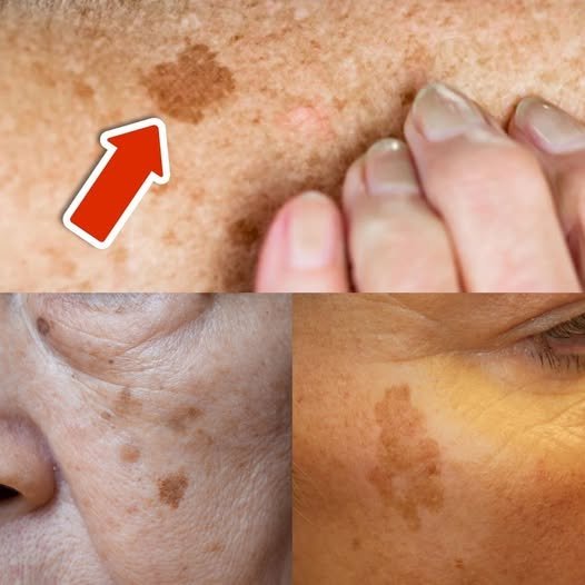 The Power of Vitamin C in Eliminating Age Spots
