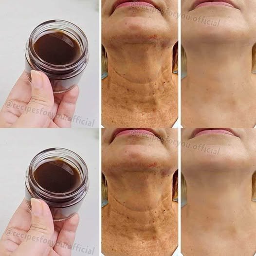The Natural Anti-Aging Power of Coffee Oil