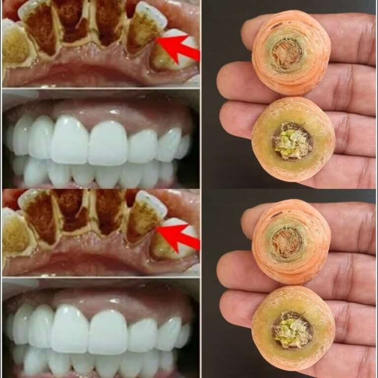 Whiten Your Teeth Naturally in 2 Minutes!Carrot Tops: A Surprising Home Remedy for a Bright Smile