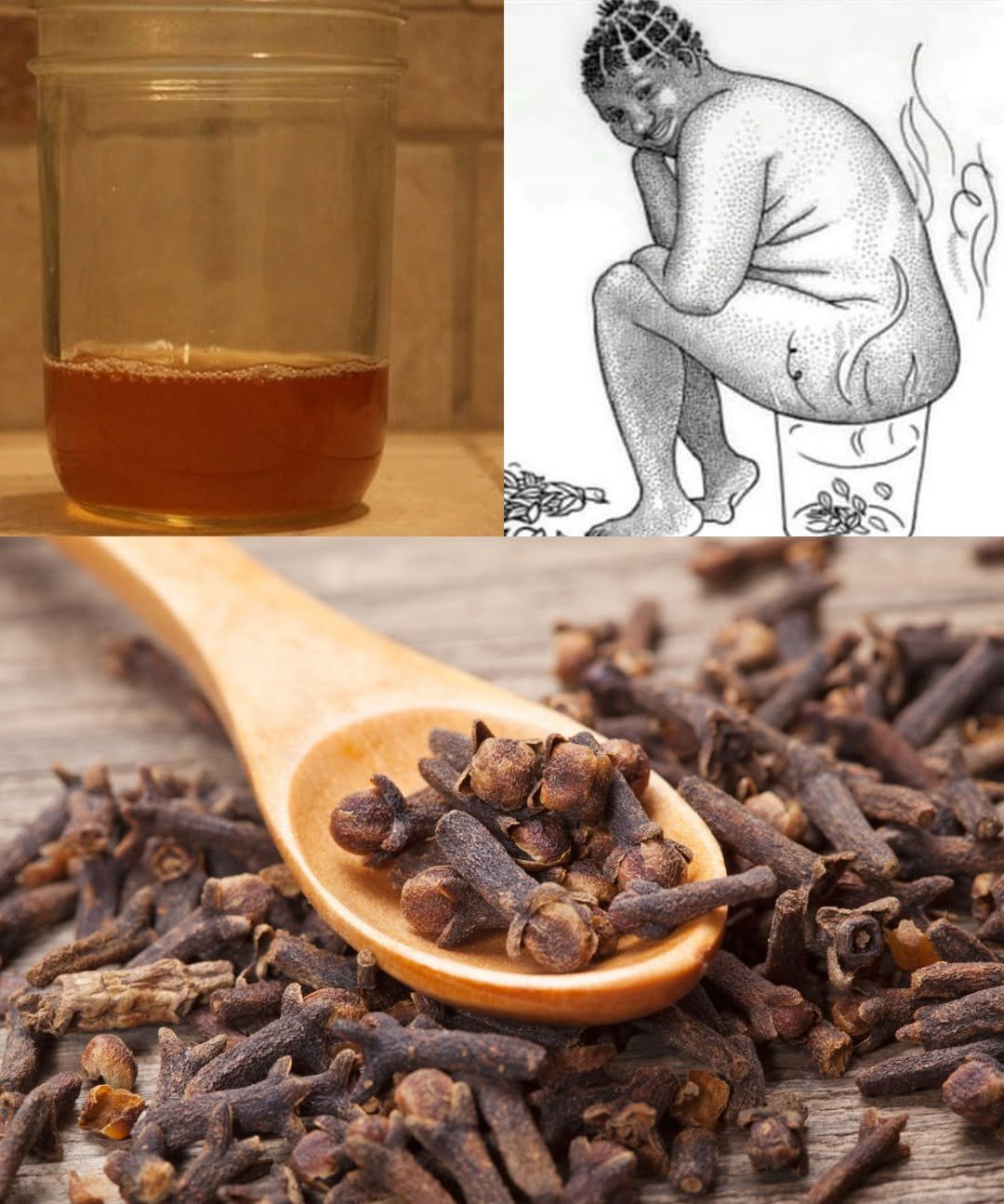 Why Putting Cloves on Your Belly Could Be the Natural Remedy You’ve Been Missing