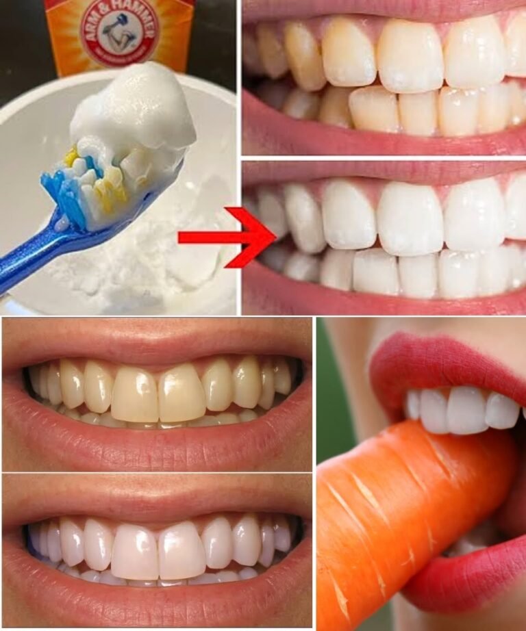 11 Natural Ways to Whiten Your Teeth Using Everyday Ingredients