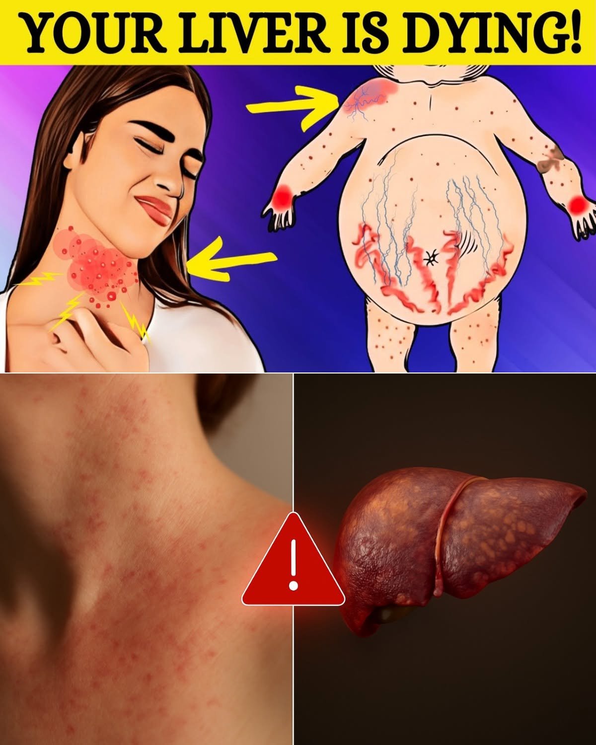 Silent Threat: 8 Subtle Signs That May Point to Fatty Liver Disease