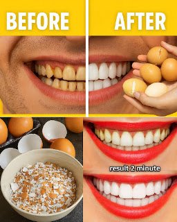 Brighten Your Smile with Simple Ingredients