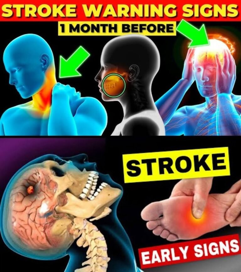 10 Warning Signs of Stroke: Symptoms You Should Never Ignore