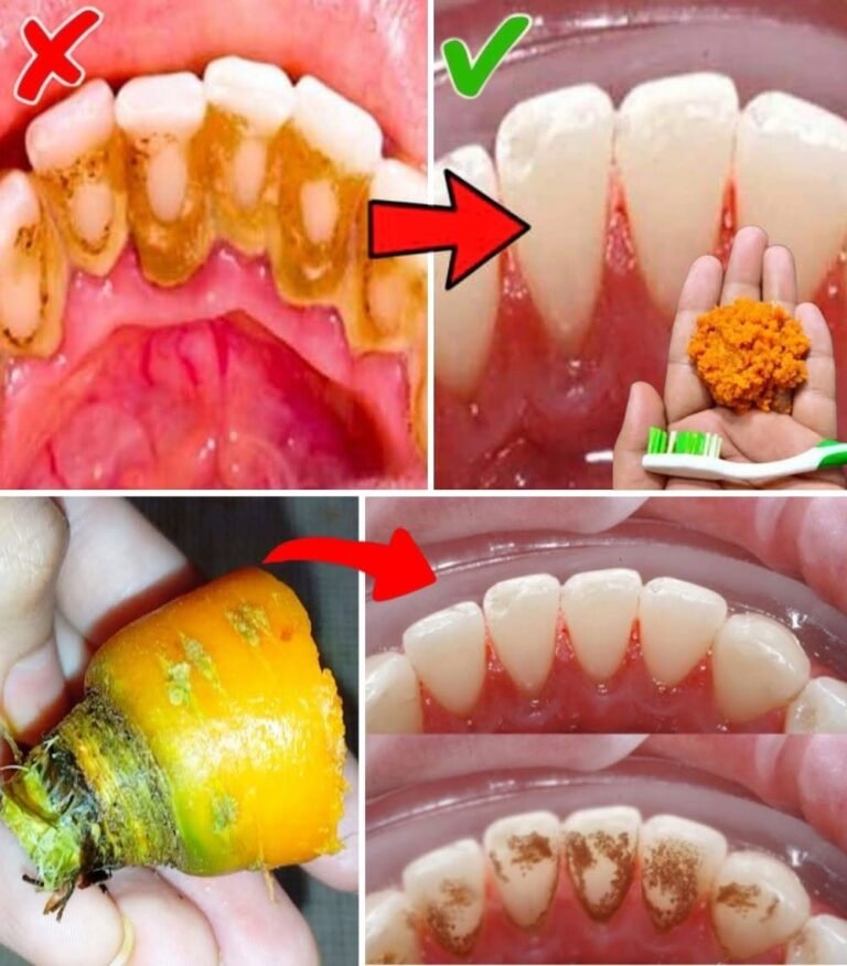 Home Teeth Whitening: Get Whiter Teeth in Just 2 Minutes!