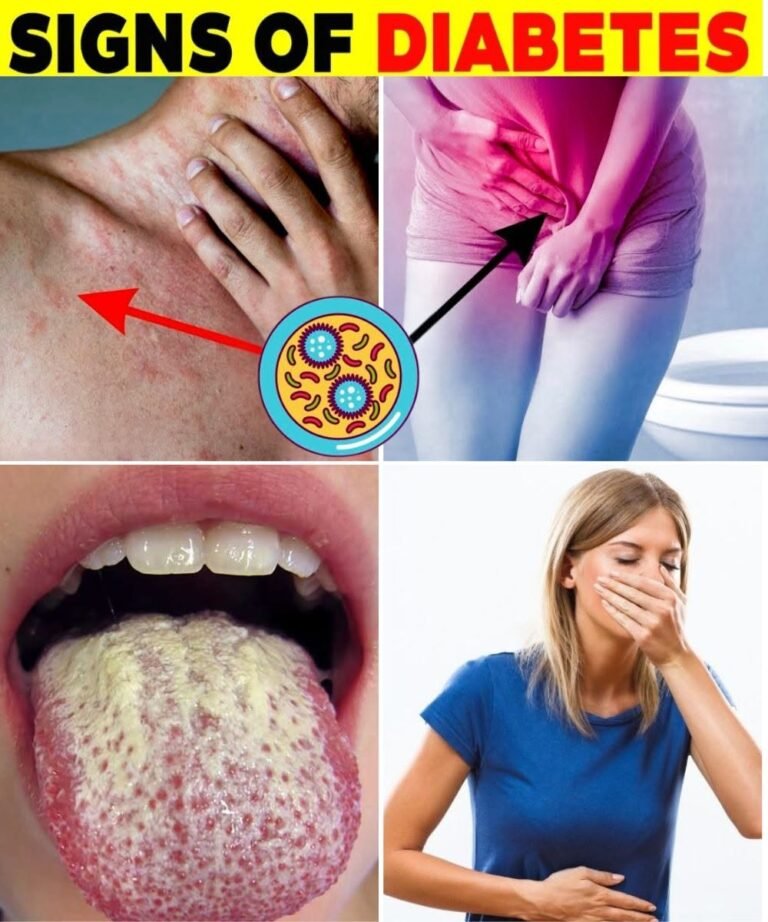 20 Signs of Diabetes You Should Never Ignore