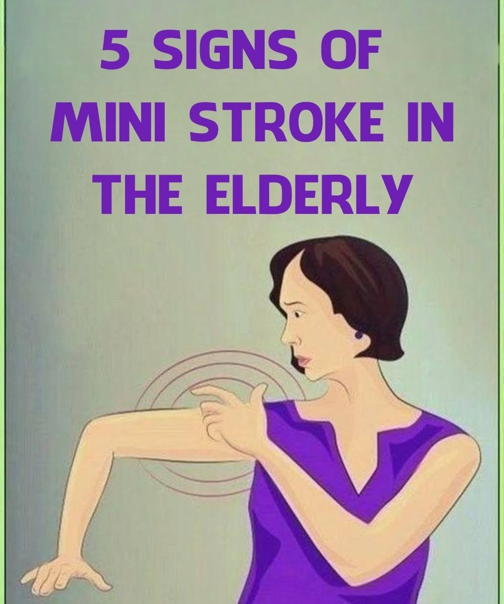 Mini Stroke in the Elderly: Common and Overlooked Symptoms