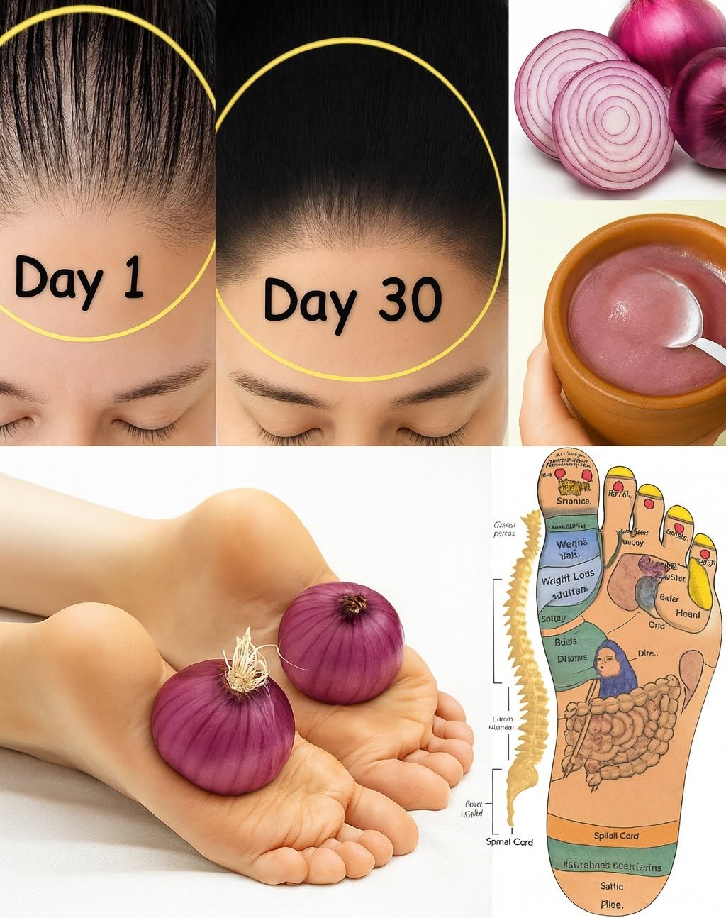 14 Ingenious Ways Onions Can Improve Your Health at Home