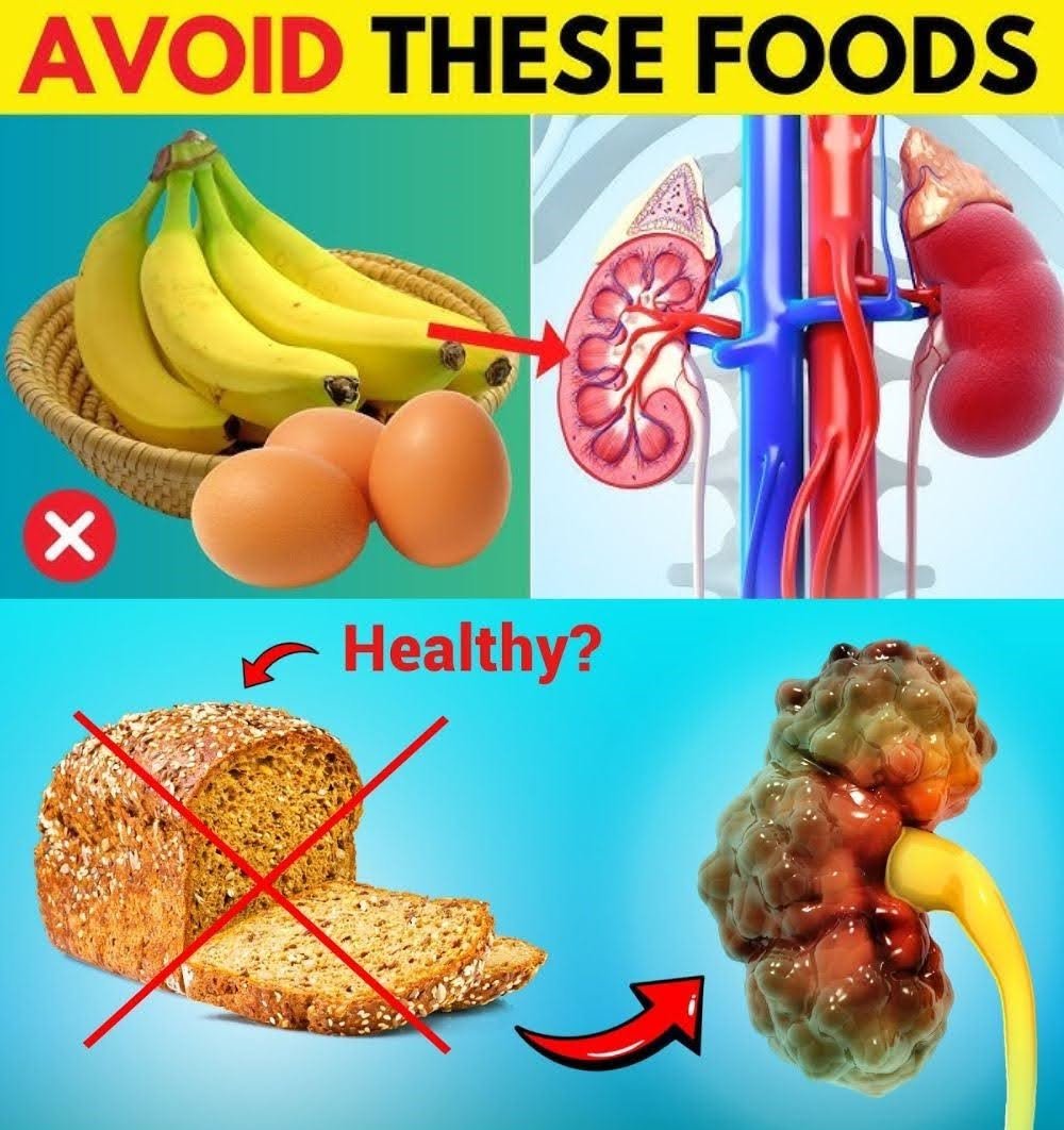 12 Foods That May Harm Your Kidneys: What You Should Avoid for Better Kidney Health