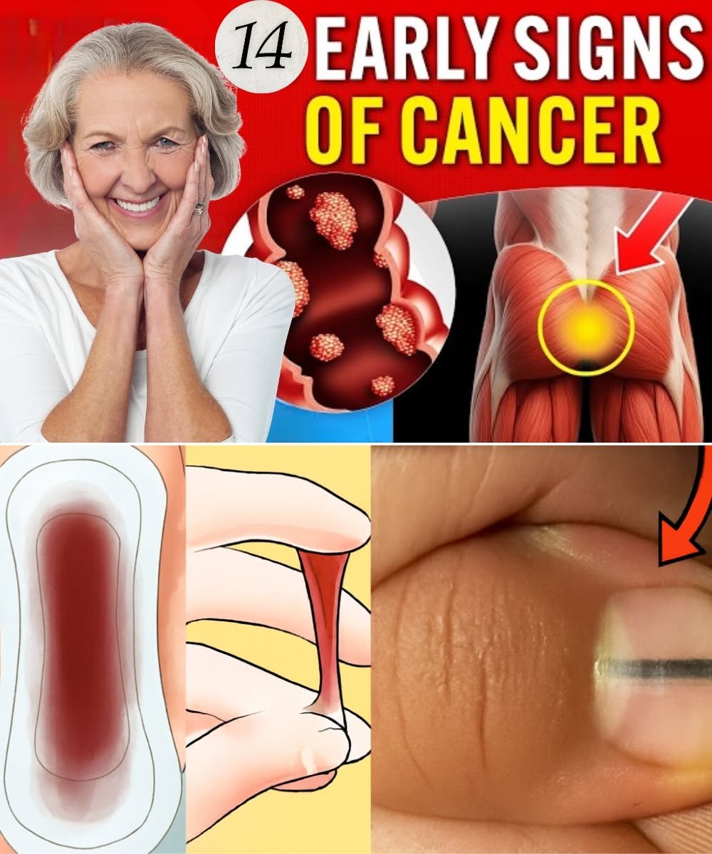 14 Visible Signs of Cancer Most Women Ignore