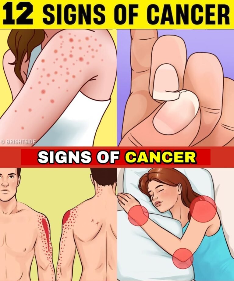 12 Early Warning Signs Your Body May Be Developing Cancer Cells