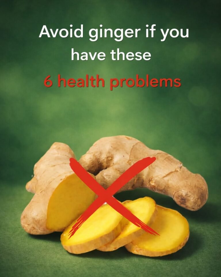 ⚠️ Ginger Isn’t Always Harmless! Here’s What You Should Know