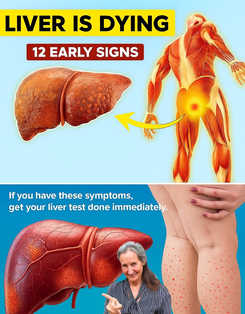 IS YOUR LIVER in DANGER? 12 Early Signs of LIVER CIRRHOSIS You Shouldn’t Ignore