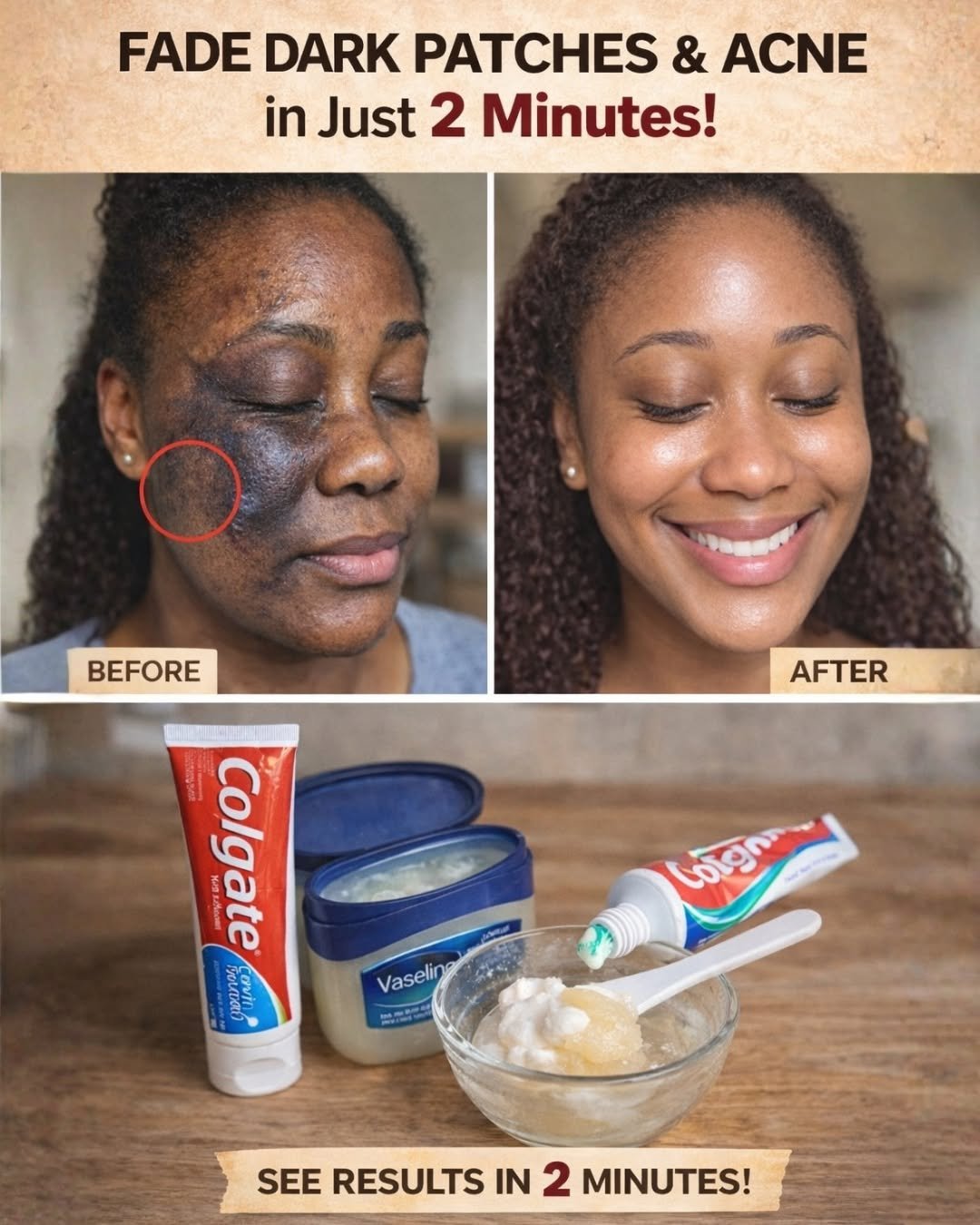 I Applied Colgate and Vaseline to My Face – The Surprising Truth Behind This Viral Beauty Hack
