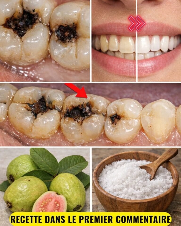 Discover the Natural Benefits of Guava Leaves: 3 Simple Ways to Support Dental Health 🌿🦷