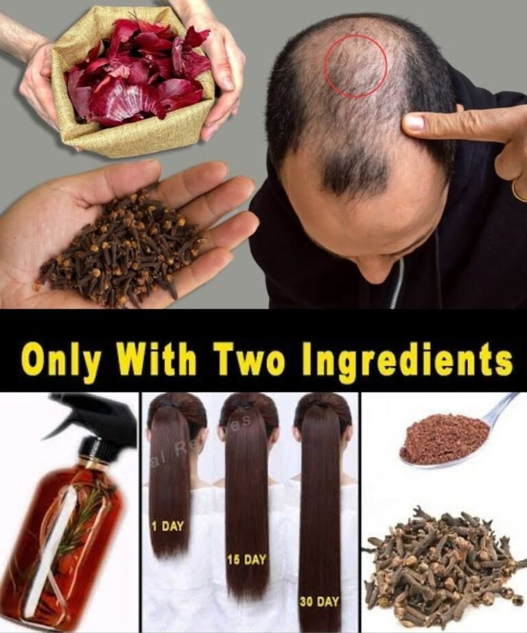 The Surprising Hair Growth Benefits of Cloves and Onion Peels