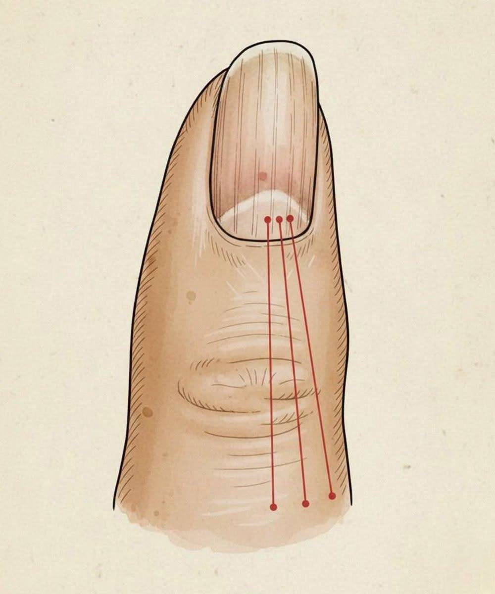 If you have these lines on your nails, you should pay attention.