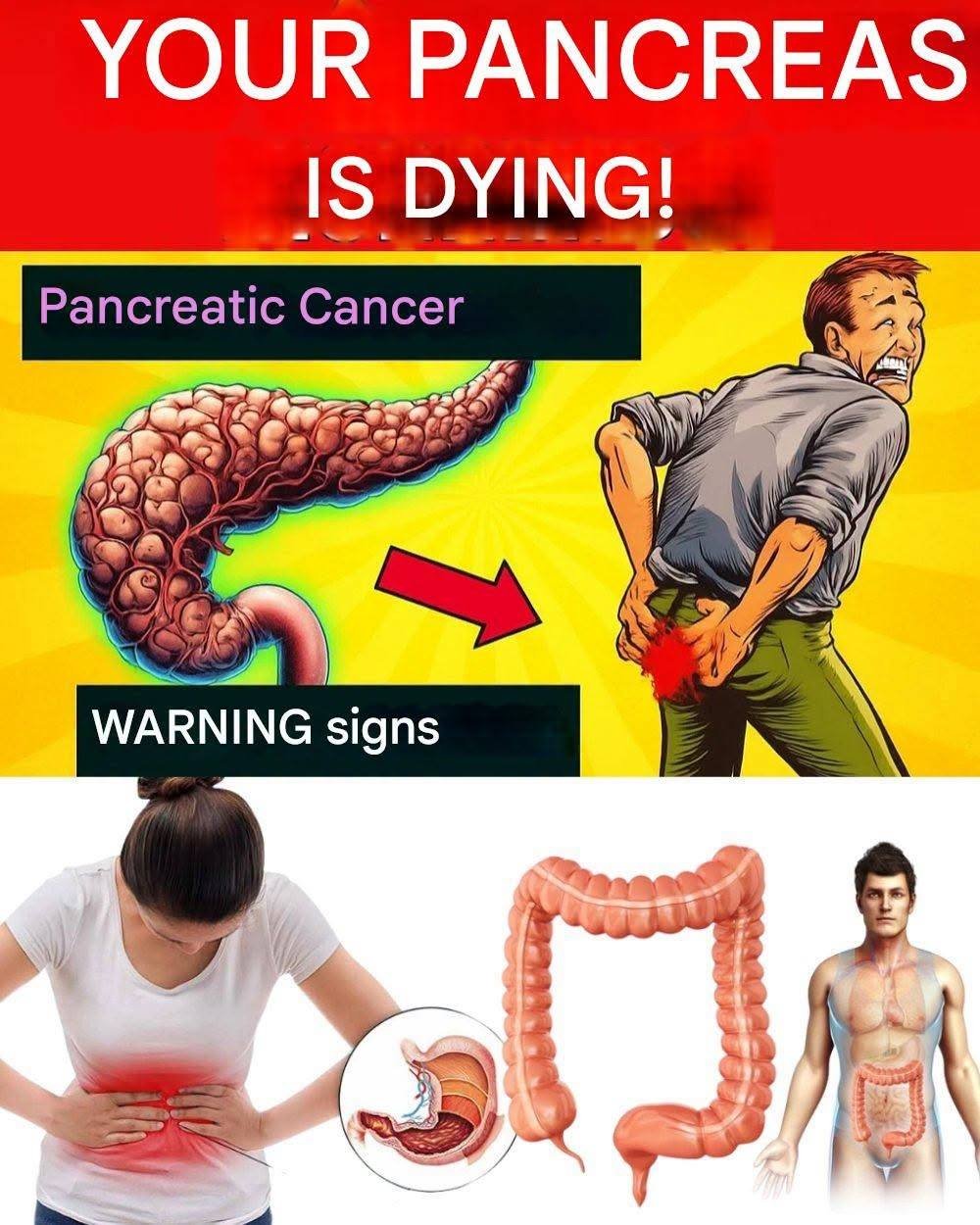 ⚠️ 8 Pancreatic Cancer Symptoms That May Surprise You