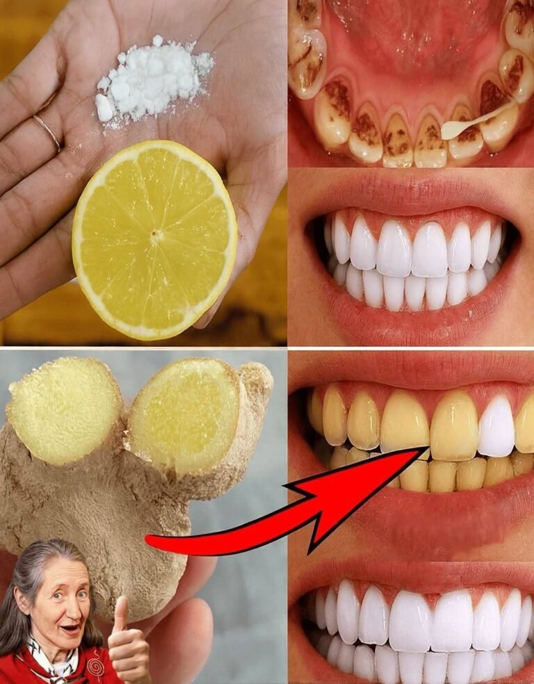 THE POWER COMBO: Whiten Your Teeth and Instantly Freshen Your Breath with the Natural Power of Ginger and Baking Soda