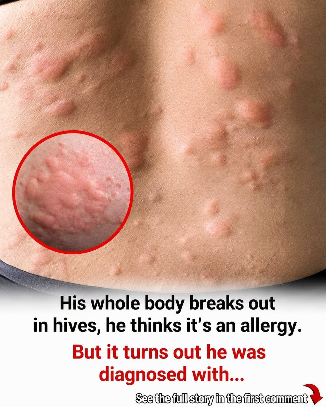 18 Possible Signs of Histamine Intolerance (And What May Be Behind Them)